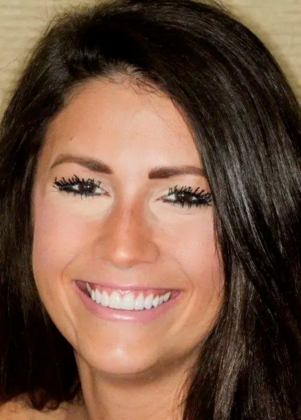 Smile Makeover & Veneers: Case 18 - After
