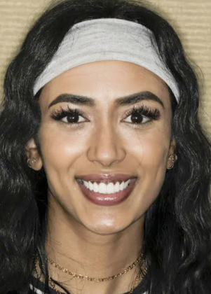 Smile Makeover & Veneers: Case 21 - After