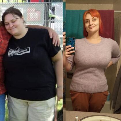 Gastric Sleeve - Click Here to See More! : Athena C - Before / After