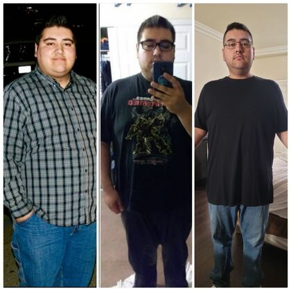 Gastric Sleeve - Click Here to See More! : Carlos C - Before / After