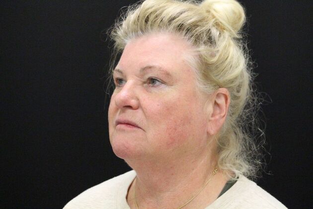 Face & Neck Lifts: Case 27 - Before