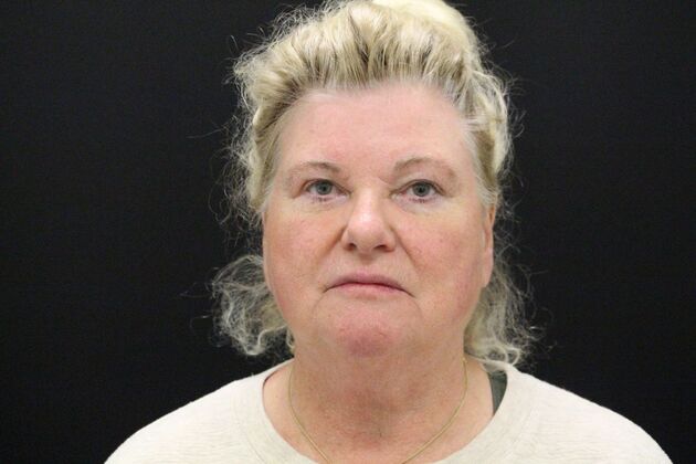 Face & Neck Lifts: Case 27 - After