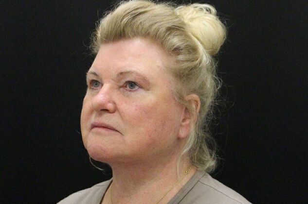 Face & Neck Lifts: Case 27 - After