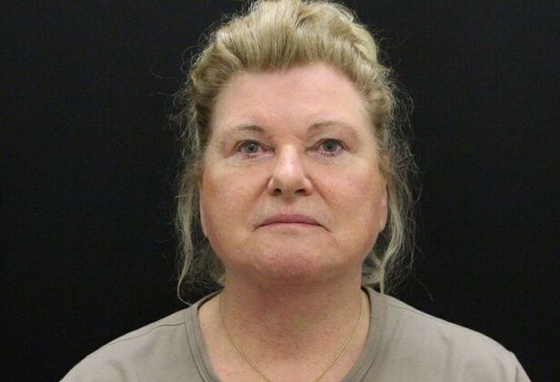 Face & Neck Lifts: Case 27 - Before