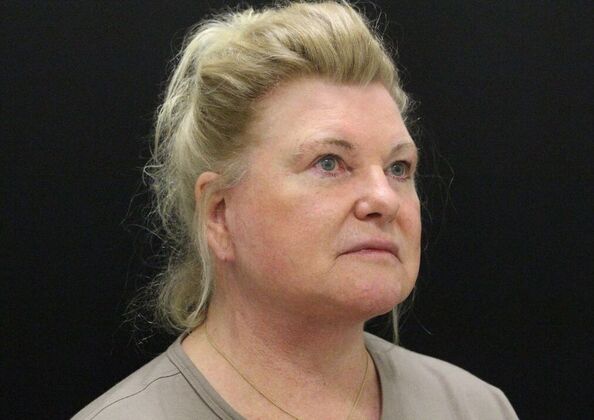 Face & Neck Lifts: Case 27 - After