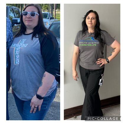 Gastric Sleeve - Click Here to See More! : Jessica M - Before & After