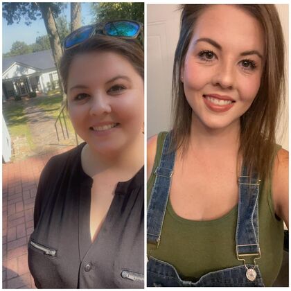 Gastric Sleeve - Click Here to See More! : Desirae C - Before & After