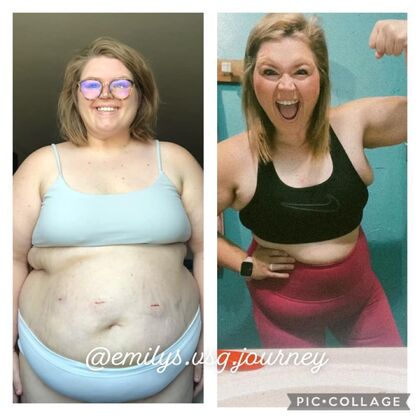 Gastric Sleeve - Click Here to See More! : Emily H - Before & After