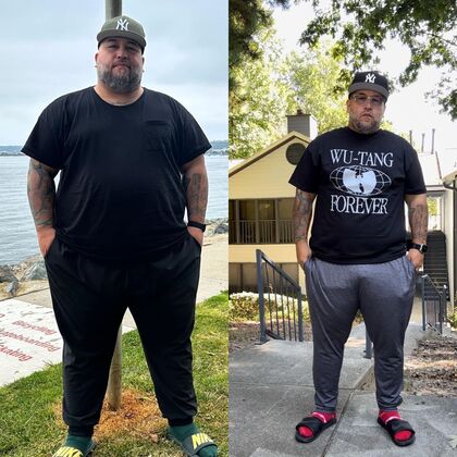 Gastric Sleeve - Click Here to See More! : Eric R - Before & After