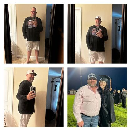 Gastric Sleeve - Click Here to See More! : Jonathan J - Before & After