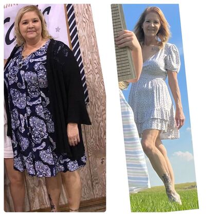 Gastric Sleeve - Click Here to See More! : Michelle E - Before & After
