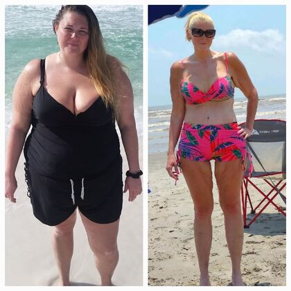 Gastric Sleeve - Click Here to See More! : Mary P - Before