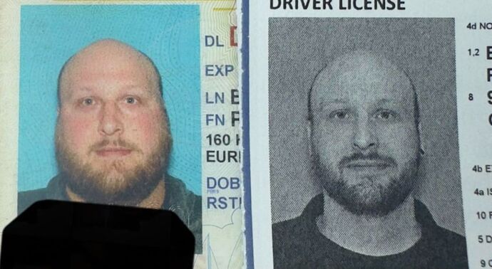 Gastric Sleeve - Click Here to See More! : Piers B - Before & After