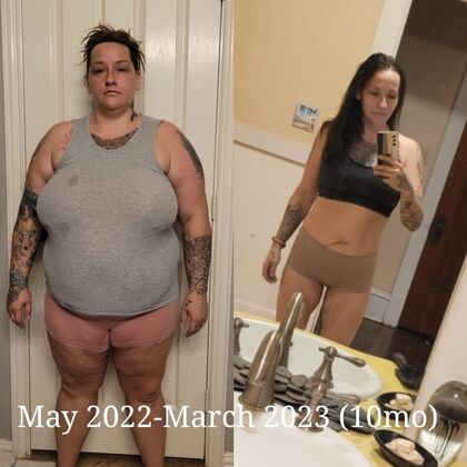 Gastric Sleeve - Click Here to See More! : Rebecca D - Before & After