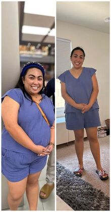 Gastric Sleeve - Click Here to See More! : Roxanne P - Before & After