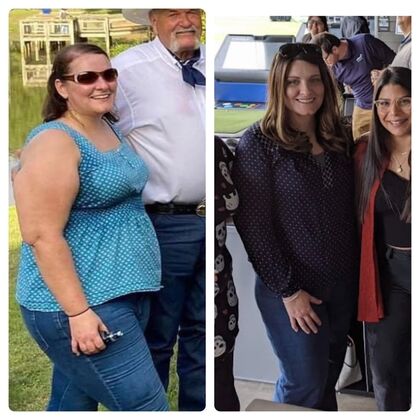 Gastric Sleeve - Click Here to See More! : Sara Marie B - Before & After