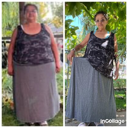 Gastric Sleeve - Click Here to See More! : Teresa C - Before & After