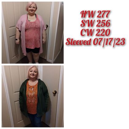 Gastric Sleeve - Click Here to See More! : Tricia S - Before & After