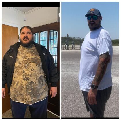 Gastric Sleeve - Click Here to See More! : Daniel S - Before & After