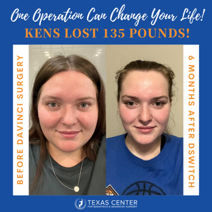 Patient Transformation Stories: Kens 6 Month and 135 Pound Transformation! - After