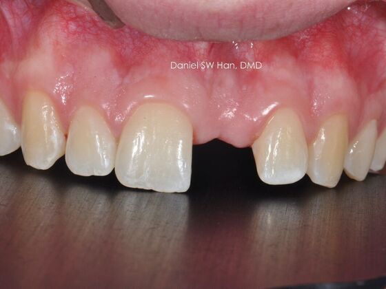 Cosmetic Dentistry: Case 8 - Before