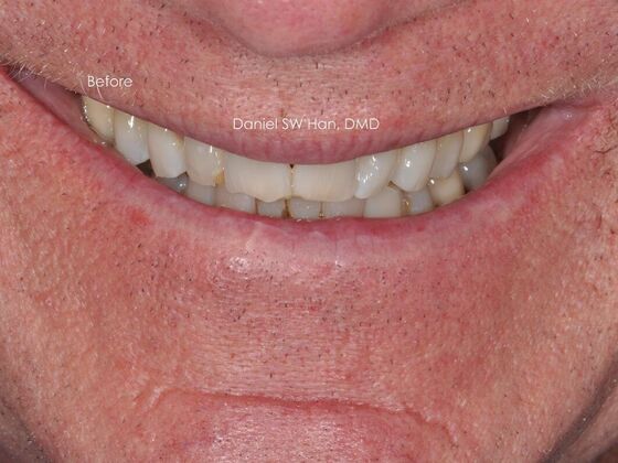 Cosmetic Dentistry: Case 9 - Before