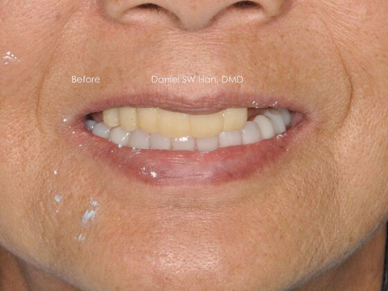 Cosmetic Dentistry: Case 11 - Before