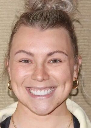 Smile Makeover & Veneers: Case 25 - After