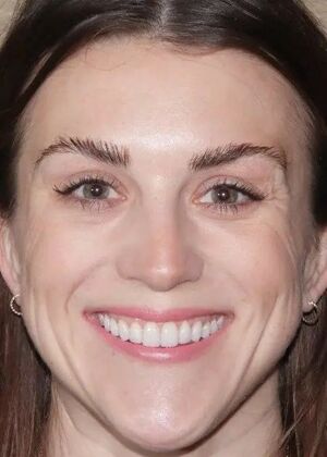 Smile Makeover & Veneers: Case 26 - After