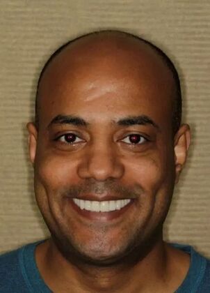 Smile Makeover & Veneers: Case 28 - After