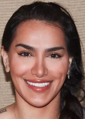 Smile Makeover & Veneers: Case 33 - After
