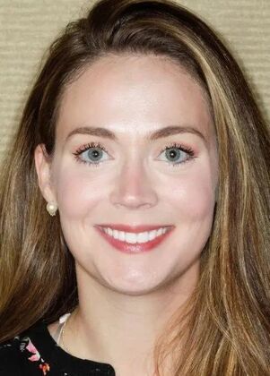 Smile Makeover & Veneers: Case 36 - After