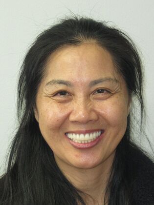 Teeth in a Day: Ecstatic to have a full bright smile again - Immediate Temps