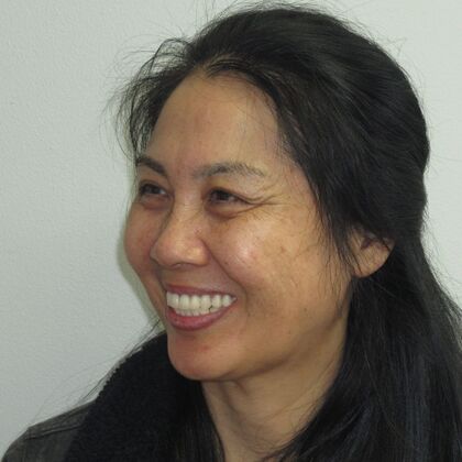 Teeth in a Day: Ecstatic to have a full bright smile again - After