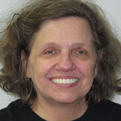 Teeth in a Day: New Teeth, New Life - After