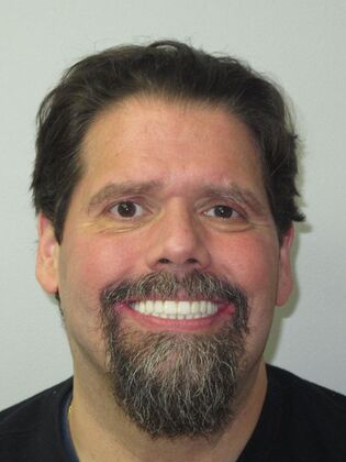 Teeth in a Day: Even a smile in ruins can return - After