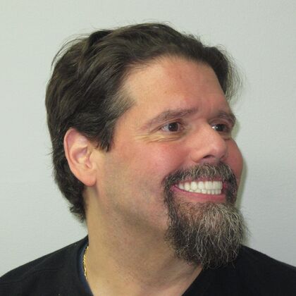 Teeth in a Day: Even a smile in ruins can return - Before