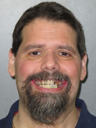 Teeth in a Day: Even a smile in ruins can return - Before