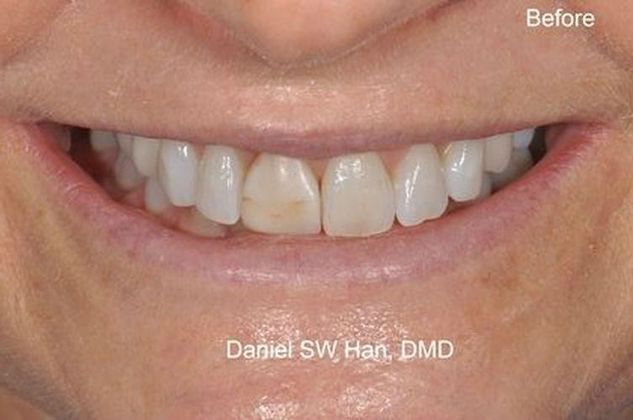Cosmetic Dentistry Case 2 - Before