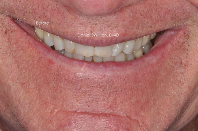 Cosmetic Dentistry: Case 7 - Before