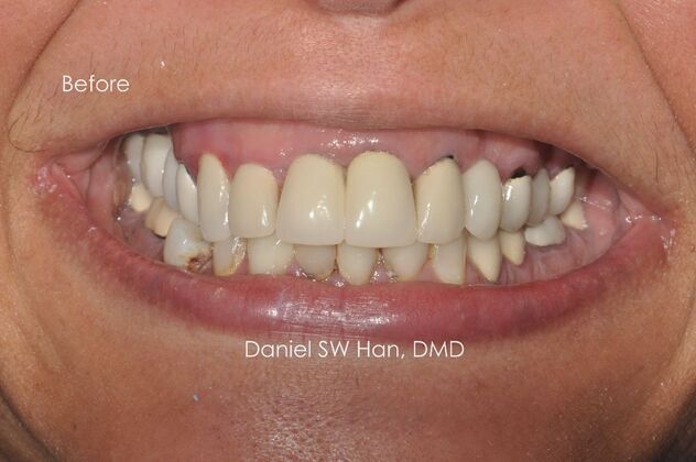 Cosmetic Dentistry: Case 12 - Before