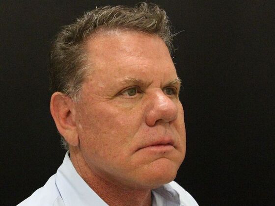 Face & Neck Lifts: Case 29 - After