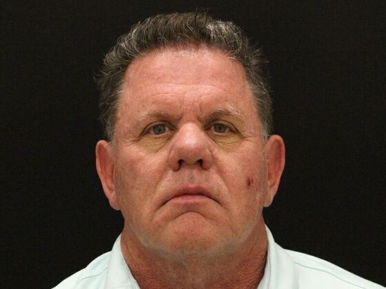 Face & Neck Lifts Case 29 - Before