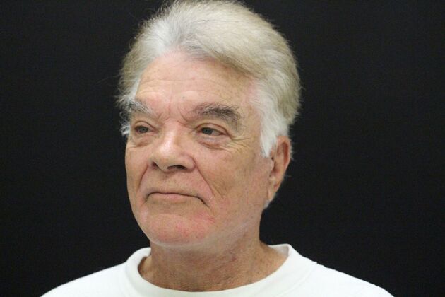 Face & Neck Lifts: Case 30 - After