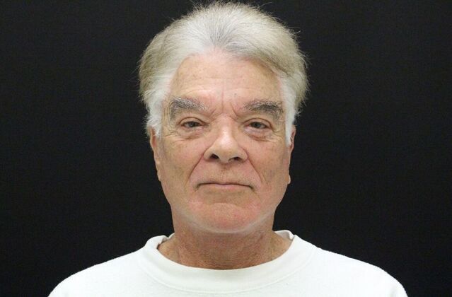 Face & Neck Lifts: Case 30 - After