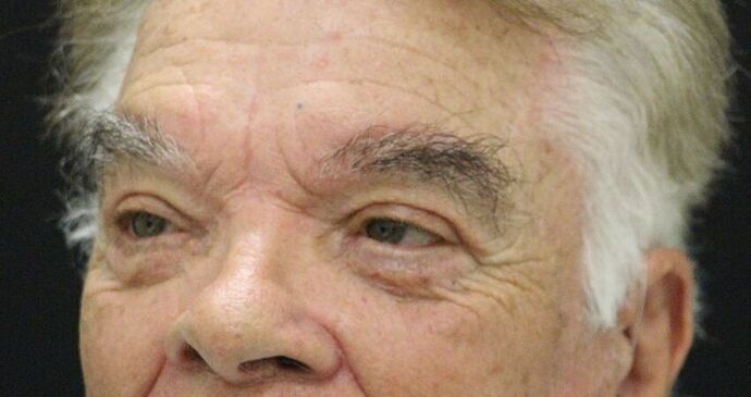 Eyelid Surgery: Case 9 - After