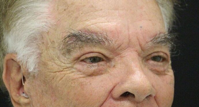 Eyelid Surgery: Case 9 - After