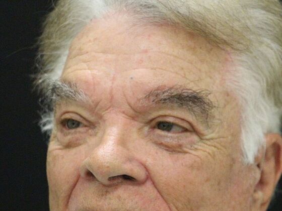 Forehead & Brow Lifts: Case 2 - After