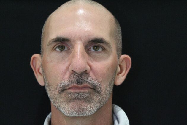 Skin Treatments Case 9 - Before