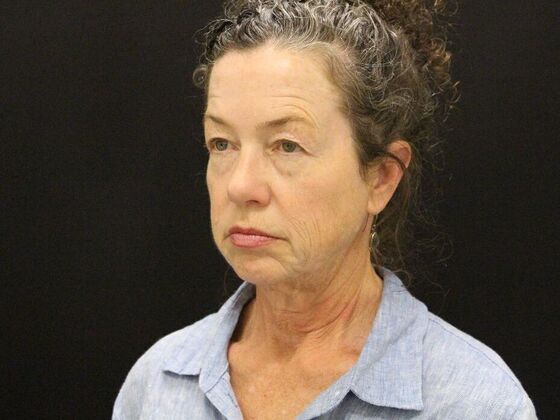 Face & Neck Lifts: Case 31 - Before